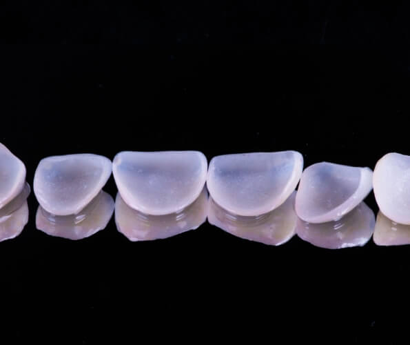 Several metal free dental restorations against black background
