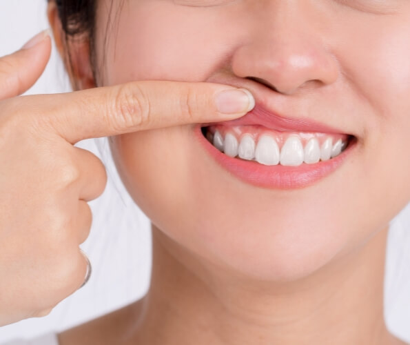 Close up of person pointing to their gums