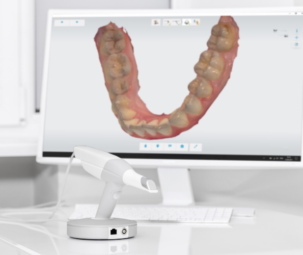 Digital impression of row of teeth on computer monitor