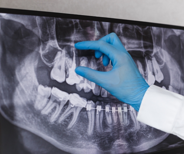 Dentist examining digital dental x rays of teeth