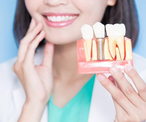 Dentist holding a model of a dental implant in the jaw