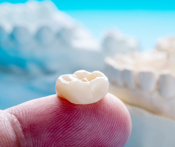 Dental crown resting on a finger